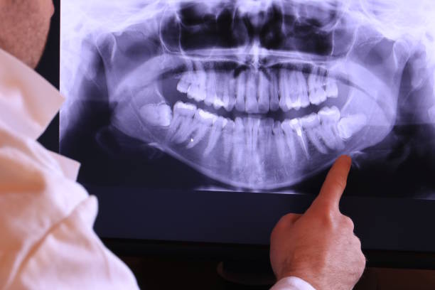 Best Emergency Root Canal Treatment in Wolfdale, PA