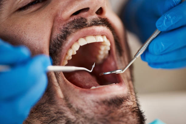 Best Emergency Treatment for Dental Infections or Abscesses in Wolfdale, PA