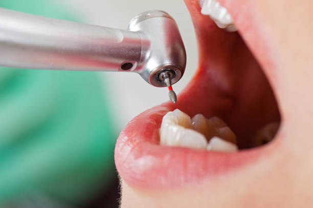 Best Cosmetic Emergency Dentistry in Wolfdale, PA